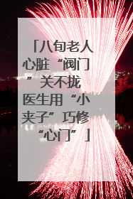 八旬老人心脏“阀门”关不拢 医生用“小夹子”巧修“心门”